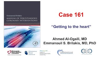 Case 161: Manual of PCI - "Getting to the heart"