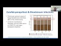 Navigating the Fungal Landscape: Antifungal Stewardship in Action