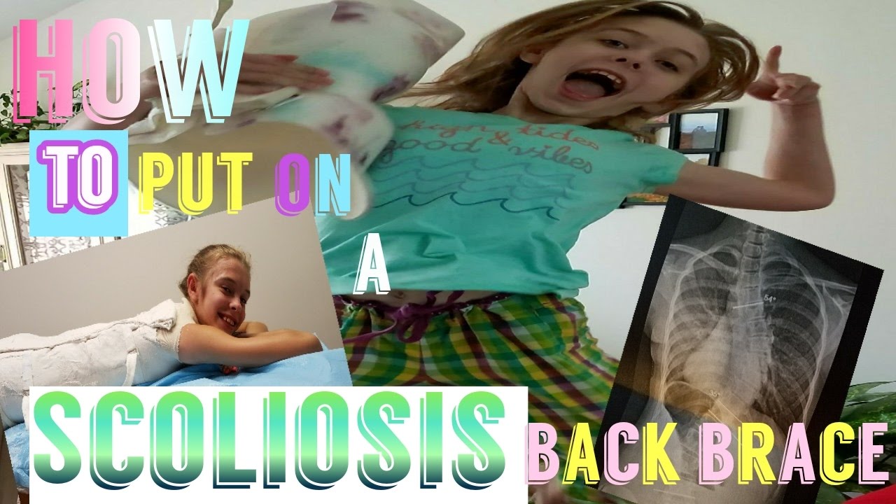 How to put on your scoliosis brace *THE RIGHT WAY* YouTube