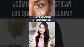 ¿Cómo se diagnostican?👩🏻‍⚕️ #salud #piel #dermatologia #quistesdemillium #medico #doctor #shorts