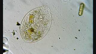 Exploding Ciliates