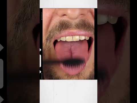 أهمية تنظيف لسانك دليل لصحة الفم المثلى الدكتورة نائلة الدغمي