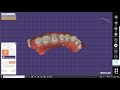 Carestream Design Software Demonstration