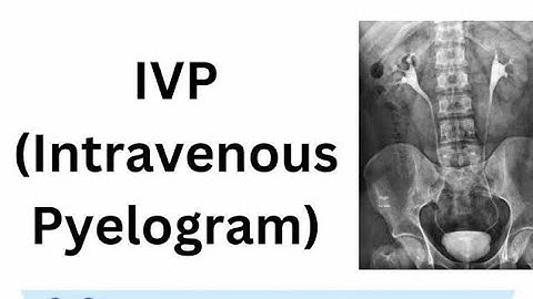Intravenous Urography Or Intravenous Pyelography Or X ray imaging of urinary tract