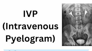 Intravenous Urography Or Intravenous Pyelography Or X Ray Imaging Of Urinary Tract