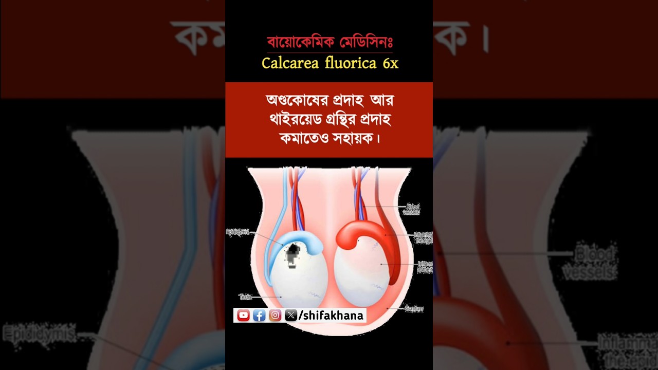Calcarea flourica 6x biochemic medicine uses in bangla