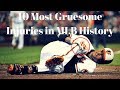 10 Most Gruesome Injuries in MLB History