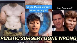 PLASTIC SURGERY GONE WRONG | PART 3