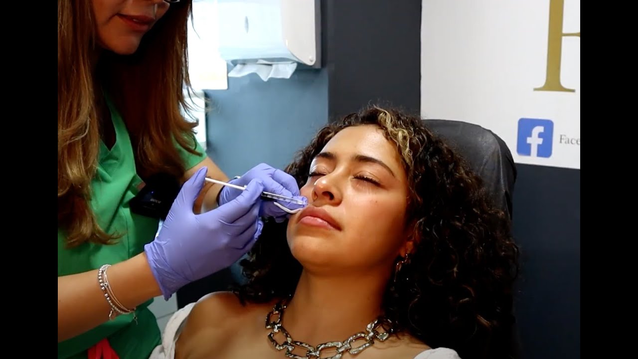 ¡Nos Inyectamos Botox y Ácido Hialurónico! Todo lo que Debes Saber: Costo, Dolor y Más
