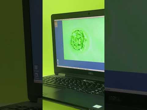 افزایش شانس بارداری با 