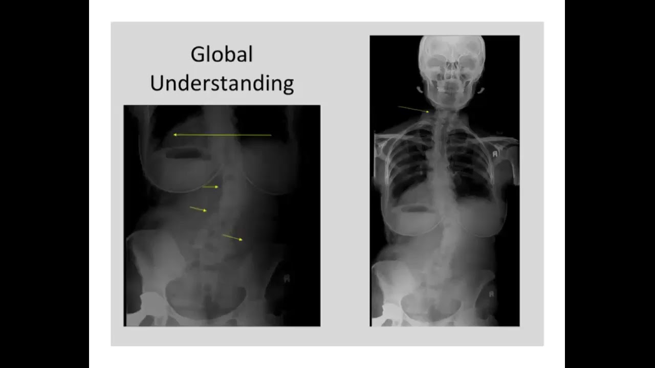 Russell Friedman's Webinar 12-2018 uppercase letter