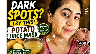 Potato Juice for Dark Spots ✨ Remove Pigmentation Naturally🪞