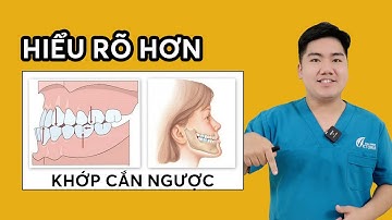 Khớp cắn ngược là gì? khớp cắn ngược niềng răng #nhakhoa #nhakhoauytin