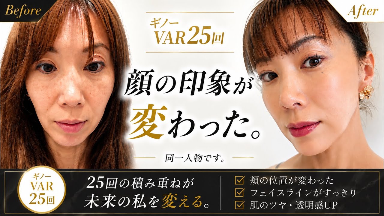エンビロン新商品】デュアルブーストクリーム【特徴・オススメの人