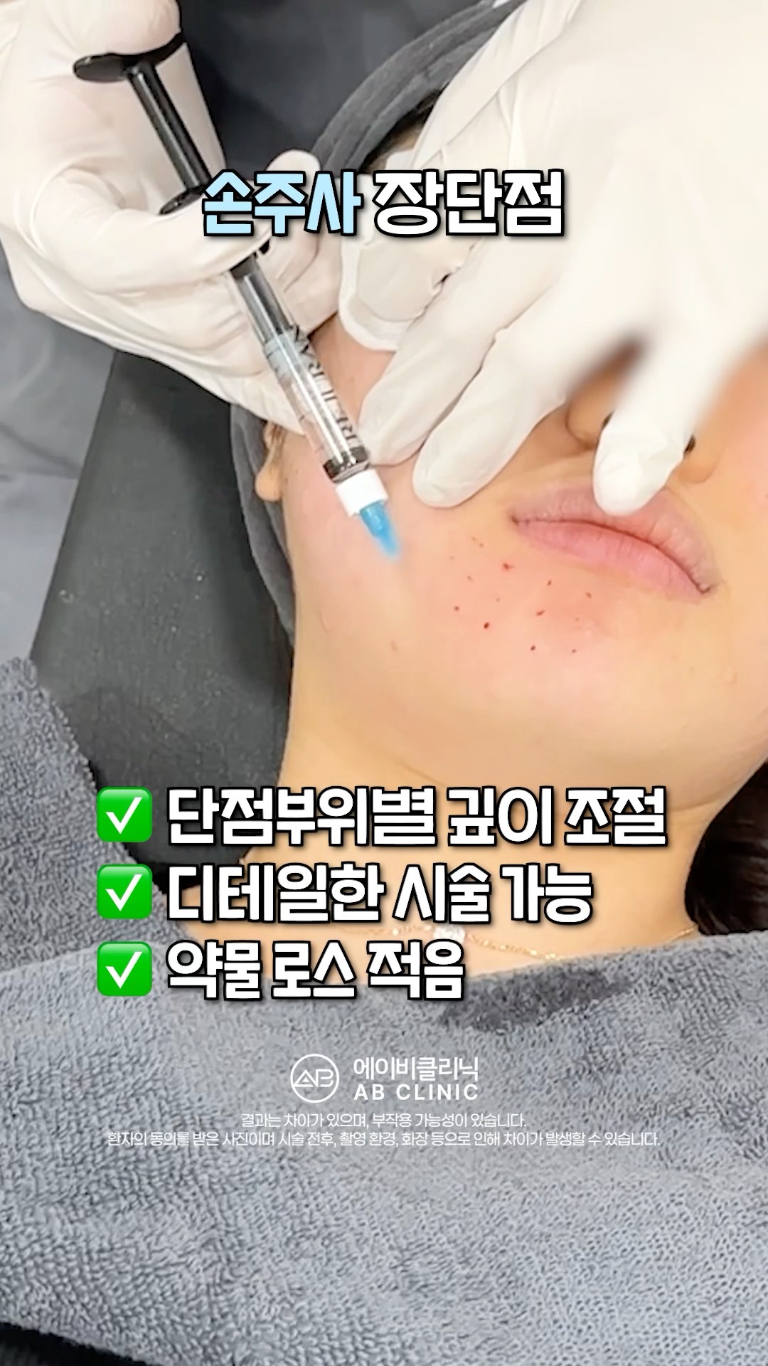 리쥬란 손주사 vs 인젝터 차이는?