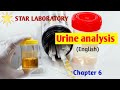 Urine analysis chapter 6urinalysis testurine analysis testurine analysis lectureurine dipstick