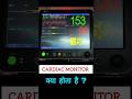 CARDIAC MONITOR क्या होता है?#@SmartMedicalKnowledge #healthcare