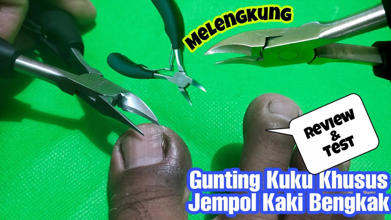 REVIEW GUNTING KUKU JEMPOL KAKI BENGKAK 