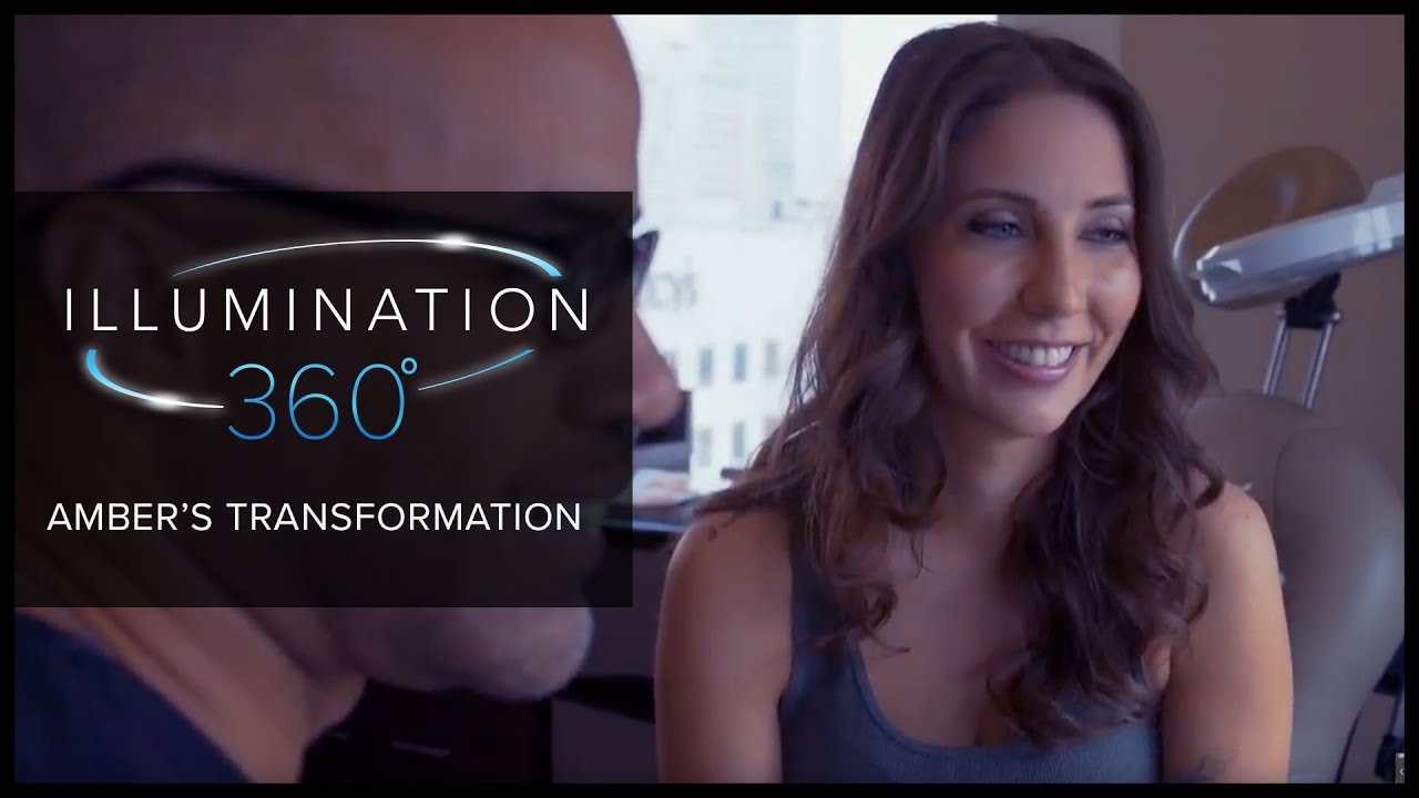 Dermal Fillers in San Francisco: Amber's Transformation