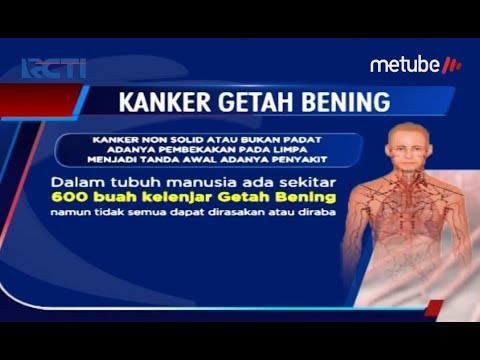 Video: Kanker Kelenjar Getah Bening - Gejala, Tahapan Dan Pengobatan Kanker Kelenjar Getah Bening, Berapa Lama Anda Hidup Dengannya?