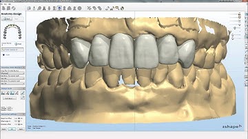 Dental System™ 2010 - Smile Composer™