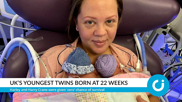 UK’s youngest twins born at 22 weeks