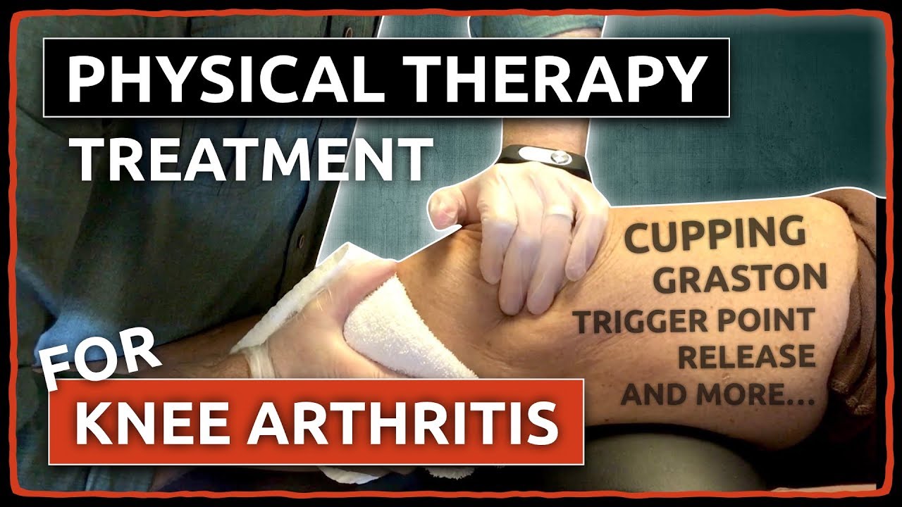 Physical Therapy Treatment for KNEE ARTHRITIS Cupping, Graston