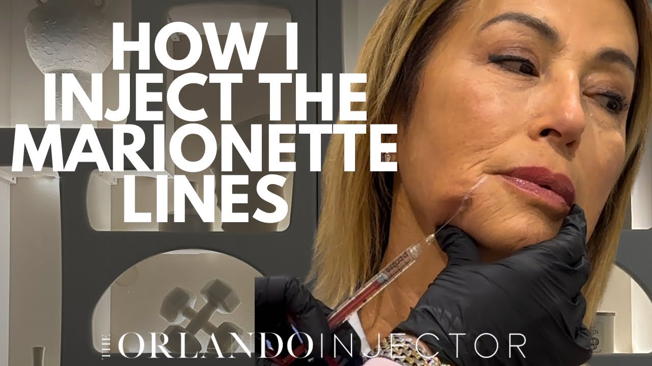 HOW I INJECT THE MARIONETTE LINES