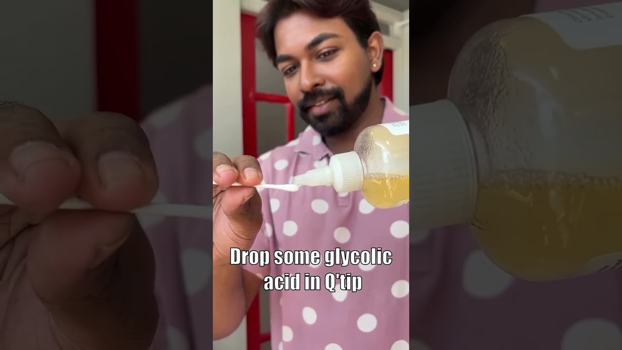 Combating dandruff!!? Lammy chennai | Hair