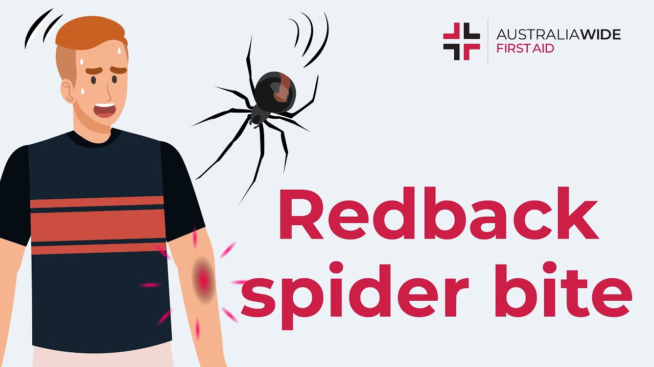 Redback Spider Bite Symptoms