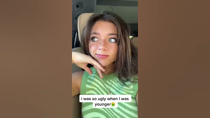 I WAS SO UGLY #shorts