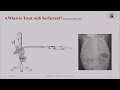 چالش های تجویز سورفکتانت در طب نوزادان. Challenges of surfactant administration on newborns