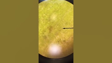 Elodea cell plasmolysis