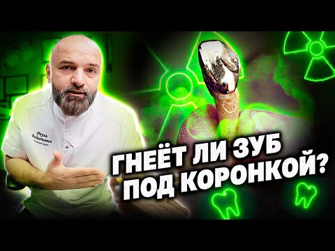 ЗУБЫ ГНИЮТ ПОД КОРОНКАМИ?