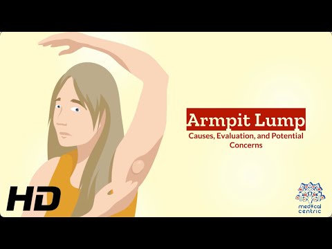 Unveiling the Mystery: Understanding Armpit Lumps