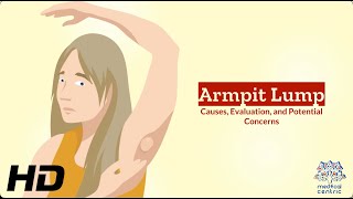 Unveiling the Mystery: Understanding Armpit Lumps