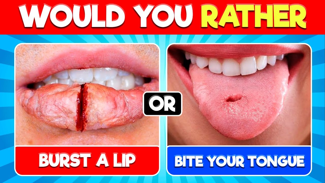 Would You Rather..? PAINFUL EDITION!! 😱