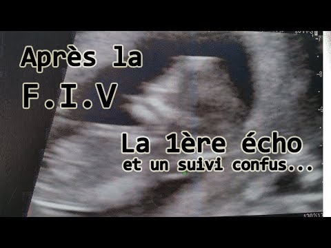 Vidéo: 6 Complications Possibles Après FIV