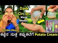 ಕಣ್ಣಿನ ಸುತ್ತ ಈ cream ಹಚ್ಚಿ, Dark circle ತಟ್ಟನೆ ಕಮ್ಮಿಯಾಗುತ್ತೆ | Dark circle removal homemade remedy