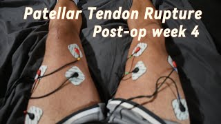 Post-op week 4 after Patellar Tendon Rupture