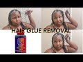 REMOVING MY GLUE IN WEAVE!!!