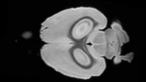 Biomedical Signal Processing