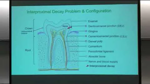 Gakenheimer May 9 2018 Partial Presentation