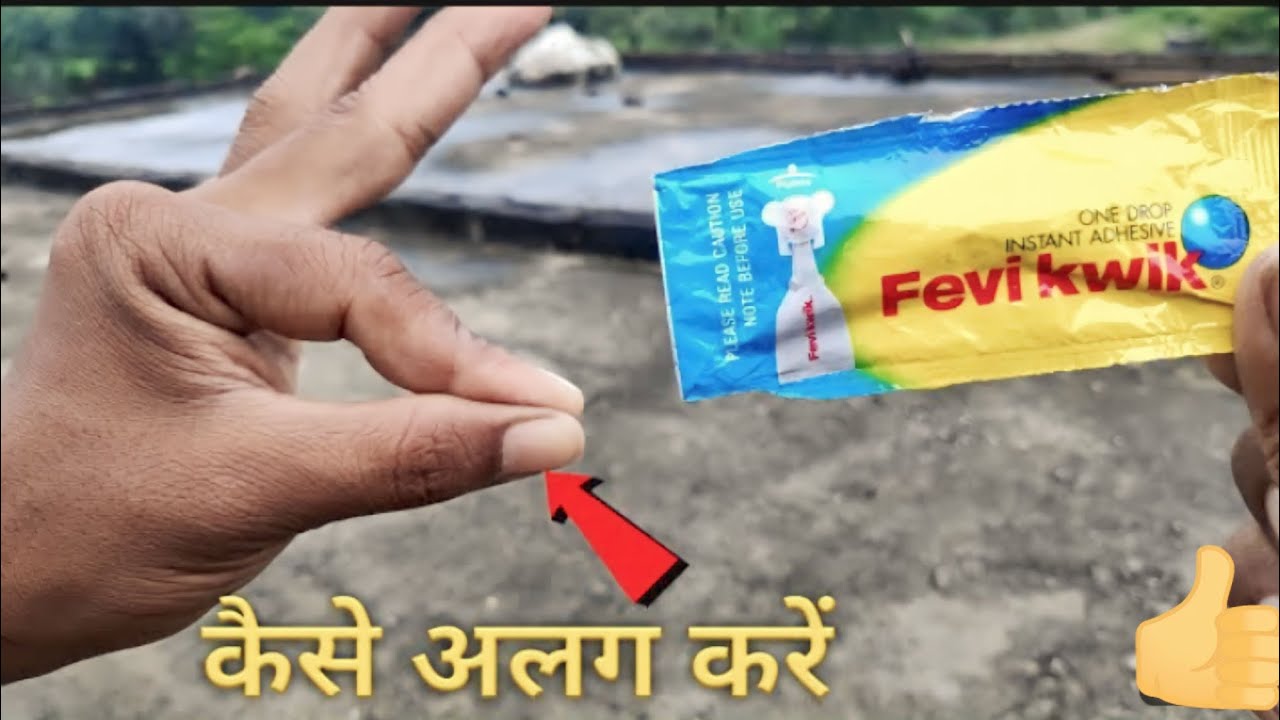 How to Remove Feviquick From Heand & any body, फेवीक्विक से चिपकी हुई