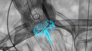 Aortic Heart Valve Implantation Advanced Device - Medical Scientific Video Production
