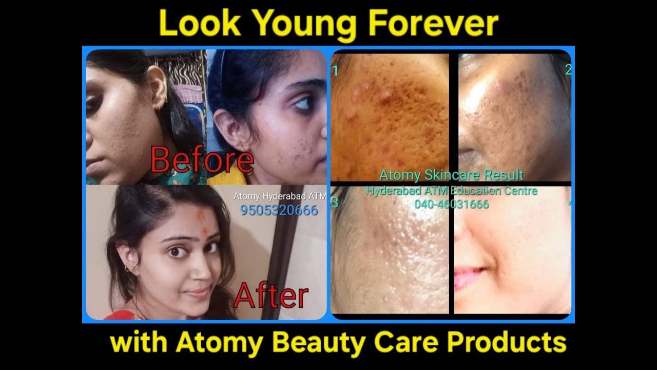 LOOK YOUNG FOREVER WITH ATOMY BEAUTY CARE PRODUCTS, ATOMY HYDRA