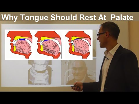 Video: Försvinner den bågade tungan?