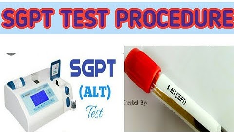 SGPT (ALT)  test procedure  in hindi urdu  sgpt test  on micro lab 300 #sgpt #TEST#MICROLAB300