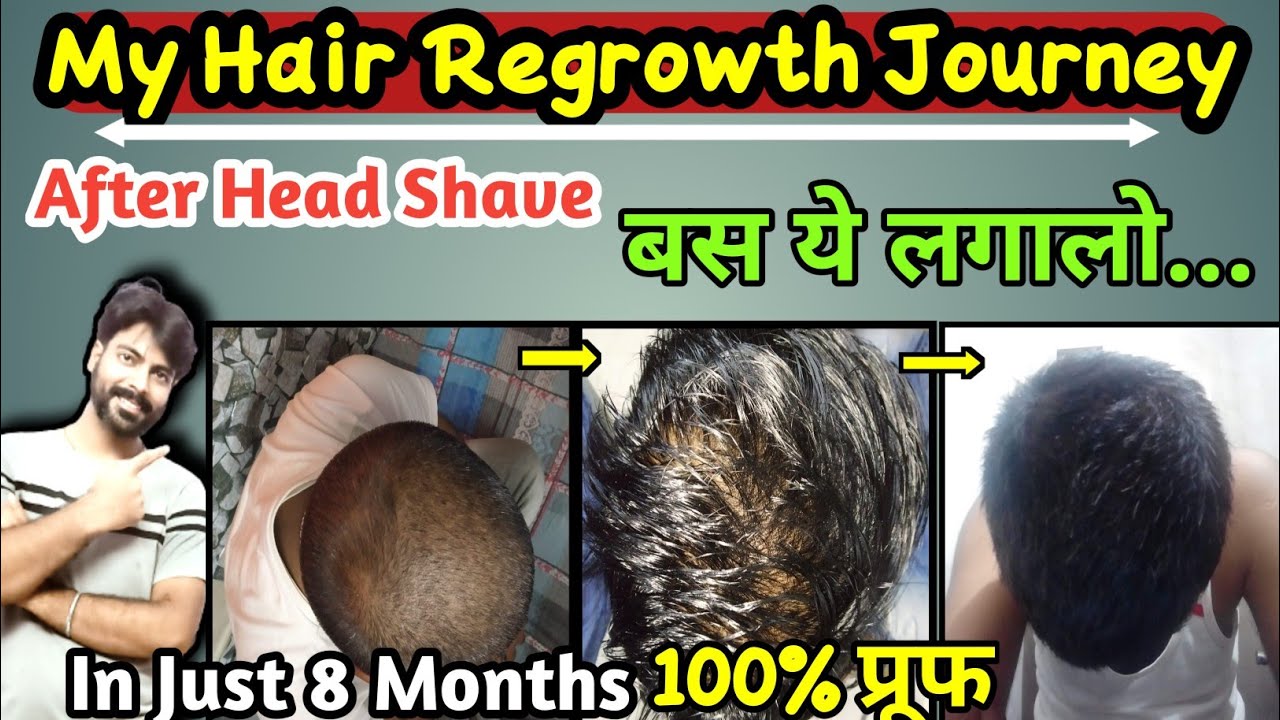 Head Shave करने के बाद क्या क्या लगाए Hair Regrowth with Head Shave