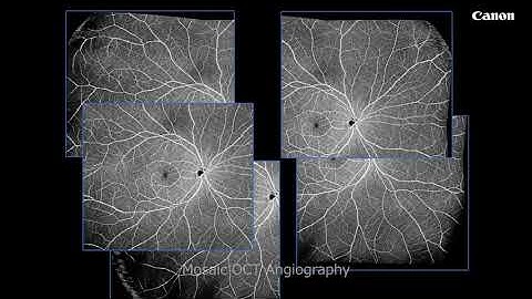 Xephilio OCT-S1-  swept source imaging in a single scan
